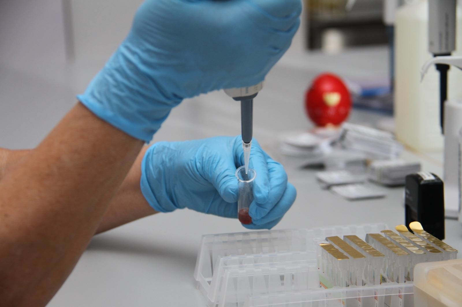 Шәует бөлінген есектен шығады