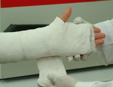 В Пензе незнакомка сломала палец девушке во время конфликта на дороге