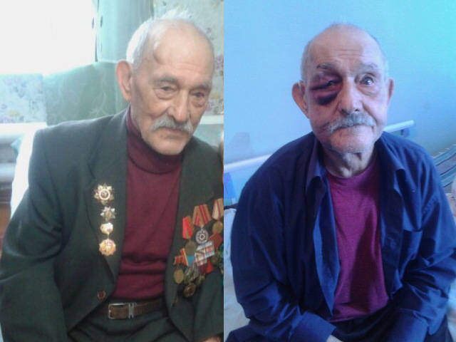 Ветеран, которого 9 мая избил грабитель и отобрал медали, незадолго до нападения успел спрятать полмиллиона тенге